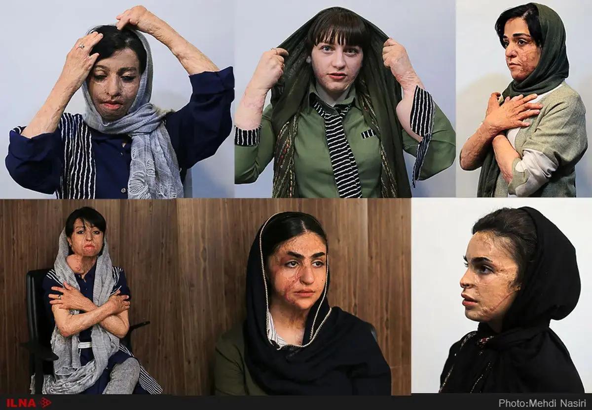 بوی تلخ مهر برای دختران سوخته شین آباد