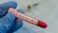 African country declares new Ebola outbreak
